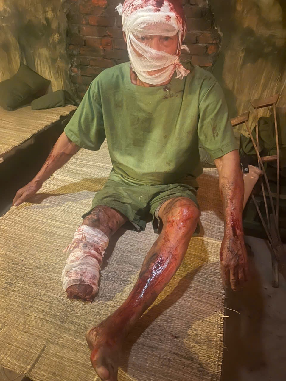 Hậu trường xúc động của 'Mưa đỏ': Khi những diễn viên đặc biệt không cần phải diễn