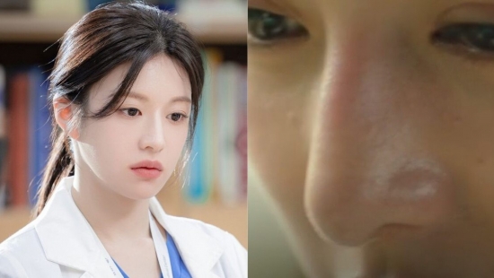 Go Youn Jung vướng tin đồn phẫu thuật thẩm mỹ