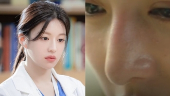 Go Youn Jung vướng tin đồn phẫu thuật thẩm mỹ