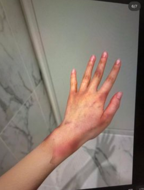 Anh trai Jisoo (BlackPink) vướng cáo buộc bạo hành vợ