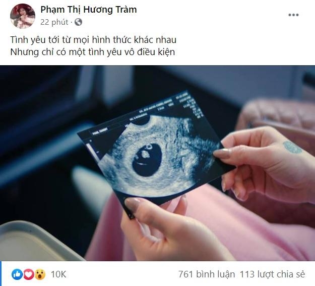 Hương Tràm khoe hình ảnh khám thai, Cao Thái Sơn bỗng dưng bị 'réo gọi'?