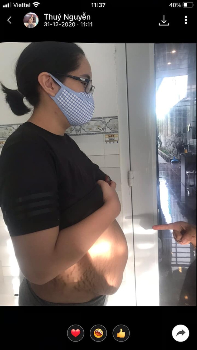 Xót xa với hình ảnh mang thai chi chít mụn của Hoa hậu Đặng Thu Thảo