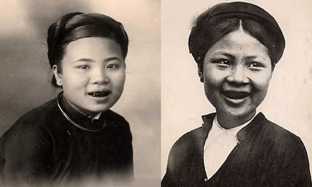 Ảnh 2: Nhuộm răng đen thể hiện sự quý phái của người phụ nữ Việt Nam xưa.