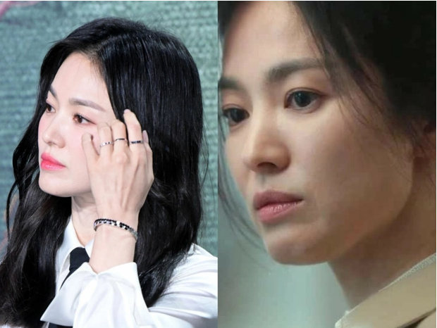 Lý do da Song Hye Kyo trong 'The Glory' xấu hơn ngoài đời?